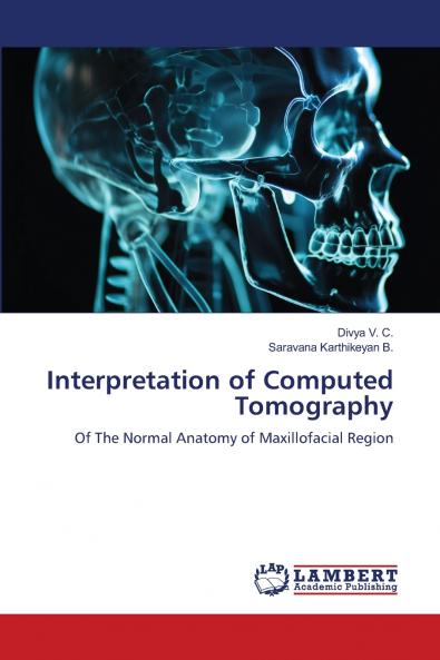 Interpretation of Computed Tomography
