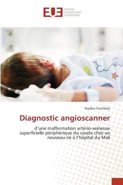 Diagnostic angioscanner