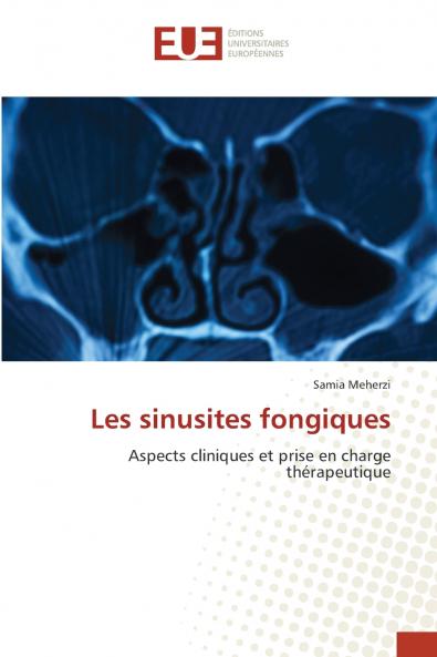 Les sinusites fongiques