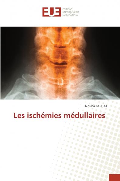 Les ischémies médullaires