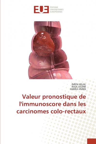 Valeur pronostique de l'immunoscore dans les carcinomes colo-rectaux