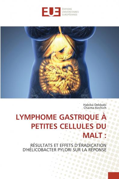 LYMPHOME GASTRIQUE À PETITES CELLULES DU MALT