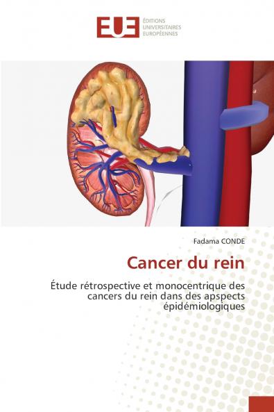 Cancer du rein
