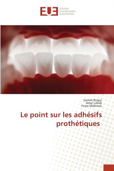 Le point sur les adhésifs prothétiques