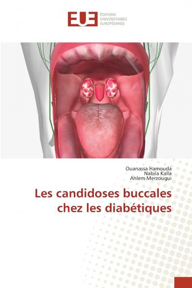 Les candidoses buccales chez les diabétiques