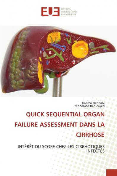 QUICK SEQUENTIAL ORGAN FAILURE ASSESSMENT DANS LA CIRRHOSE