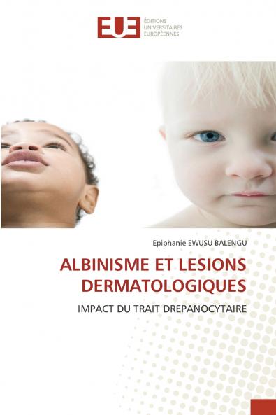 ALBINISME ET LESIONS DERMATOLOGIQUES