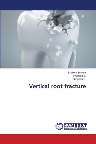 Vertical root fracture