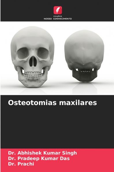 Osteotomias maxilares