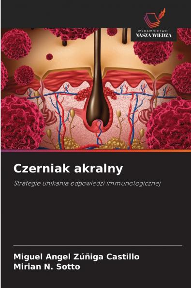 Czerniak akralny
