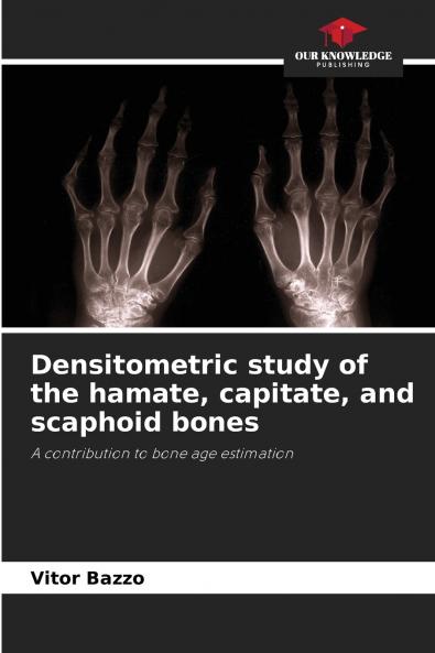 Densitometric study of the hamate capitate and scaphoid bones