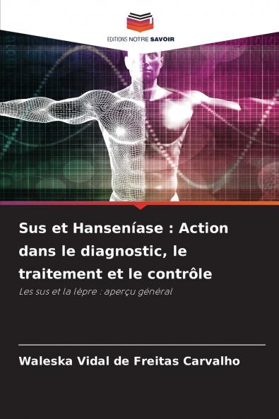 Sus et Hanseníase