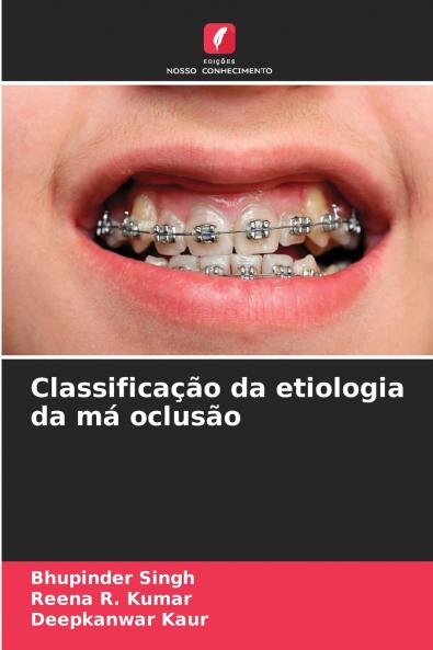Classificação da etiologia da má oclusão