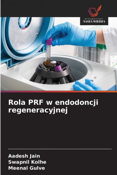 Rola PRF w endodoncji regeneracyjnej