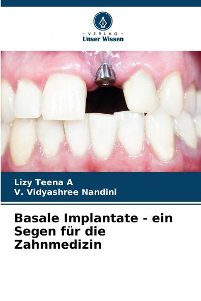 Basale Implantate - ein Segen für die Zahnmedizin