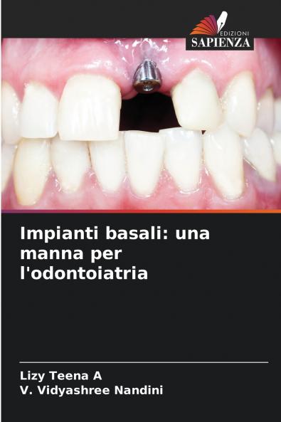 Impianti basali