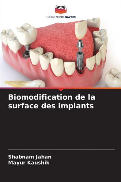 Biomodification de la surface des implants