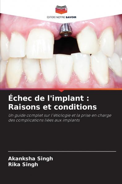 Échec de l'implant