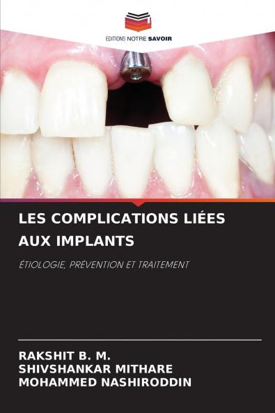LES COMPLICATIONS LIÉES AUX IMPLANTS