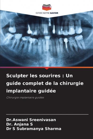 Sculpter les sourires