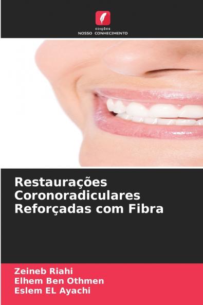 Restaura����es Coronoradiculares Refor��adas com Fibra
