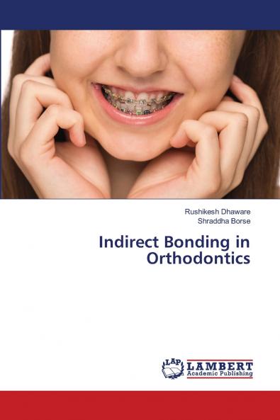 Indirect Bonding in Orthodontics