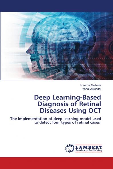Deep Learning-Based Diagnosis of Retinal Diseases Using OCT
