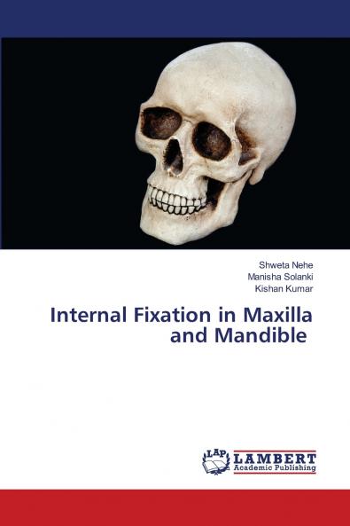 Internal Fixation in Maxilla and Mandible