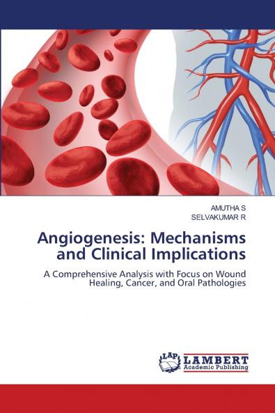 Angiogenesis