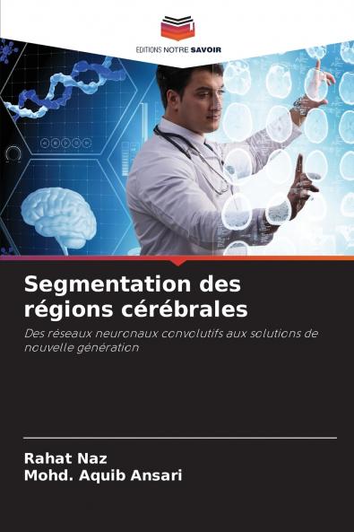 Segmentation des régions cérébrales