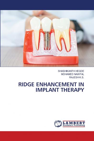 RIDGE ENHANCEMENT IN IMPLANT THERAPY