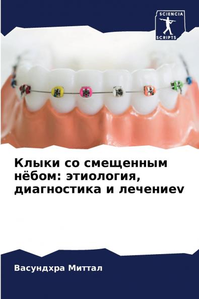 ????? ?? ????????? ?????