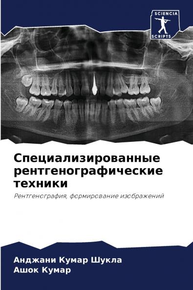 ?????????????????? ??????????????????? ???????