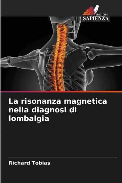 La risonanza magnetica nella diagnosi di lombalgia