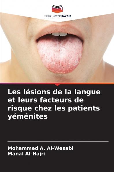 Les lésions de la langue et leurs facteurs de risque chez les patients yéménites