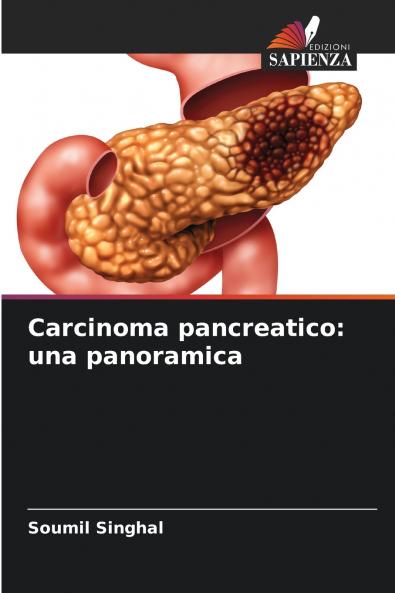 Carcinoma pancreatico
