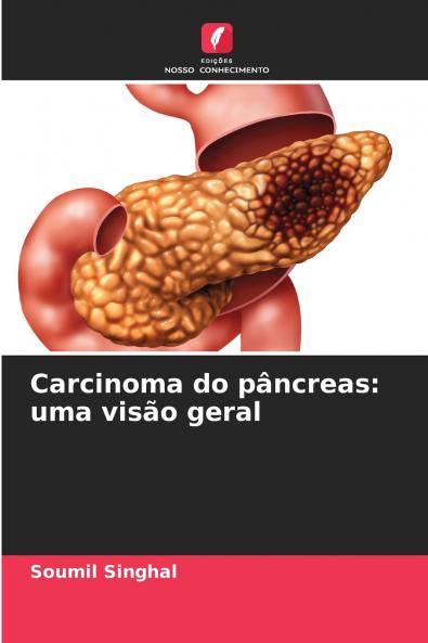 Carcinoma do pâncreas