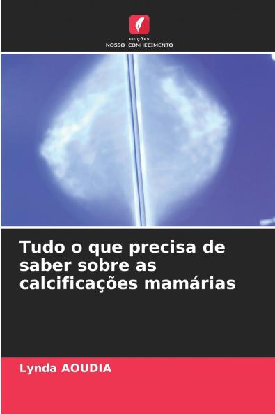 Tudo o que precisa de saber sobre as calcificações mamárias