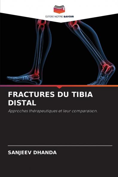 FRACTURES DU TIBIA DISTAL