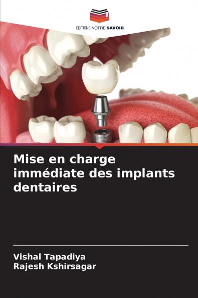 Mise en charge immédiate des implants dentaires