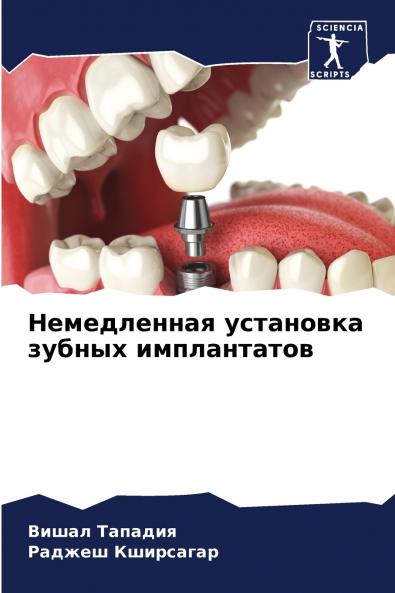 ??????????? ????????? ?????? ???????????