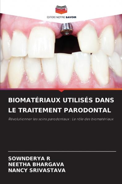 BIOMATÉRIAUX UTILISÉS DANS LE TRAITEMENT PARODONTAL