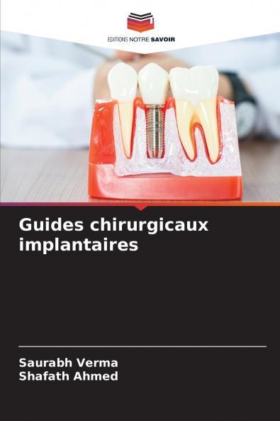 Guides chirurgicaux implantaires