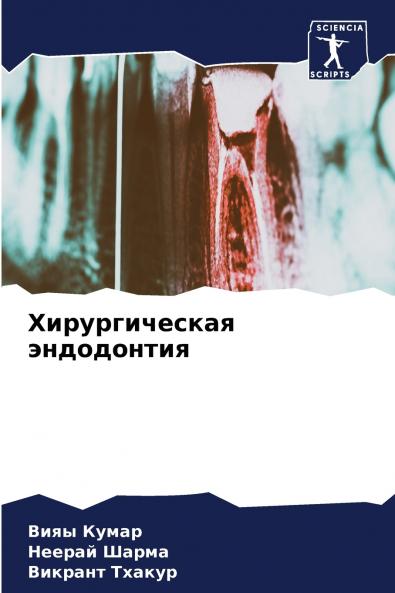 ????????????? ??????????