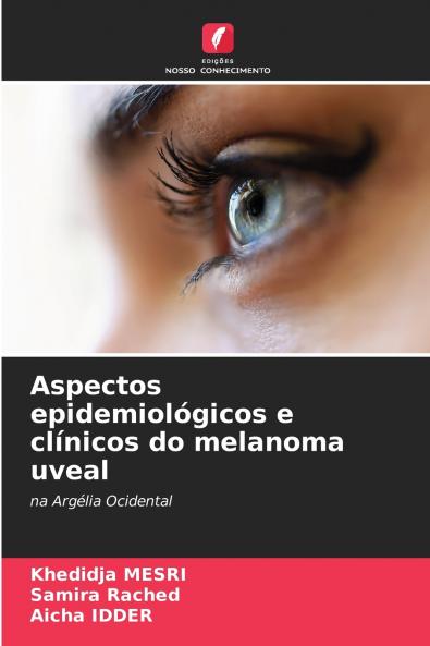 Aspectos epidemiológicos e clínicos do melanoma uveal