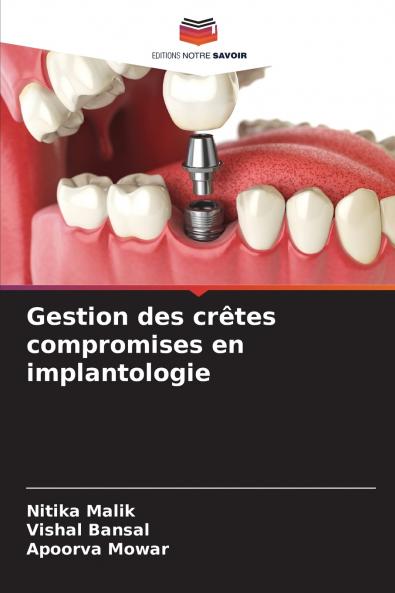 Gestion des crêtes compromises en implantologie
