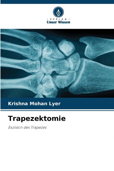 Trapezektomie