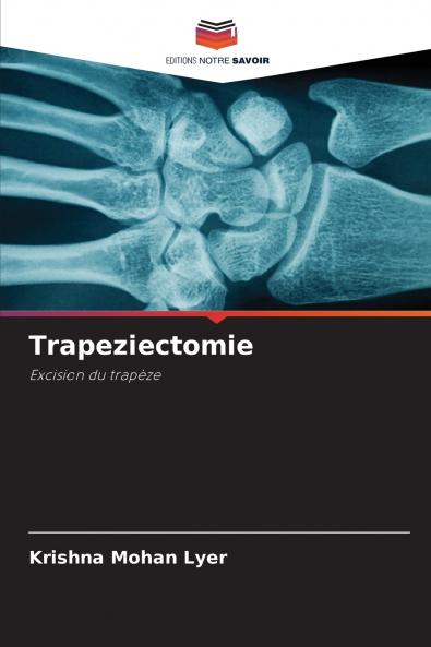 Trapeziectomie