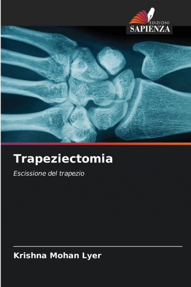 Trapeziectomia