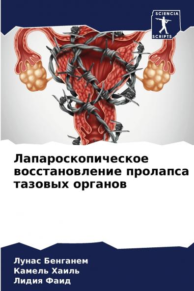 Лапароскопическое восстановление пролапса тазовых органов